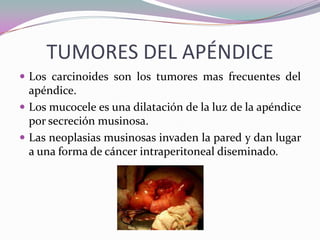 TUMORES DEL APÉNDICE
 Los carcinoides son los tumores mas frecuentes del
apéndice.
 Los mucocele es una dilatación de la luz de la apéndice
por secreción musinosa.
 Las neoplasias musinosas invaden la pared y dan lugar
a una forma de cáncer intraperitoneal diseminado.
 