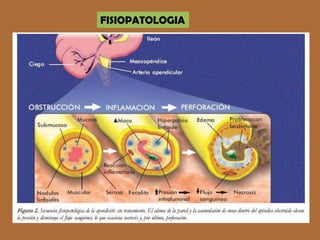 FISIOPATOLOGIA