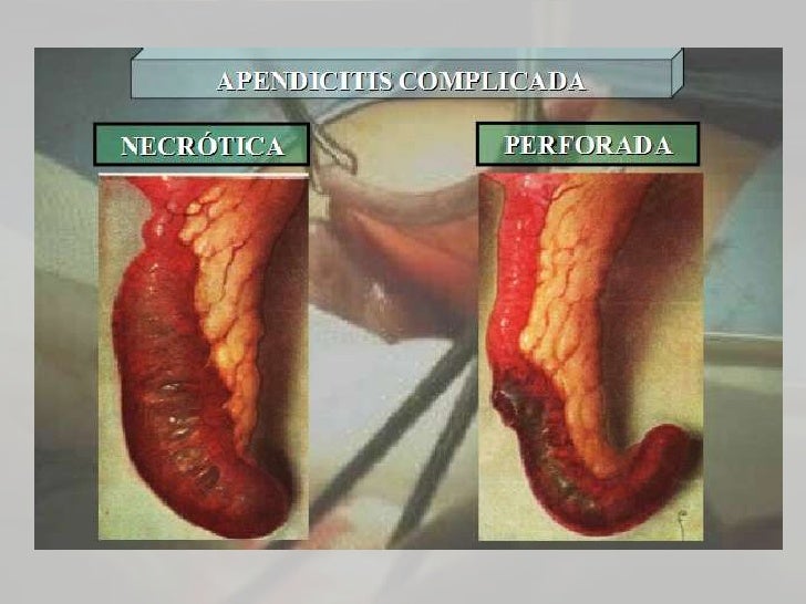 Sheynyy la osteocondrosis los síntomas el tratamiento la vista