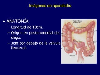 Imágenes en apendicitis ANATOMÍA Longitud de 10cm. Origen en posteromedial del ciego. 3cm por debajo de la válvula ileocecal. 