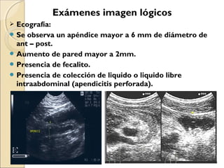 Exámenes imagen lógicos
Ecografía:
 Se observa un apéndice mayor a 6 mm de diámetro de
ant – post.
 Aumento de pared mayor a 2mm.
 Presencia de fecalito.
 Presencia de colección de liquido o liquido libre
intraabdominal (apendicitis perforada).


 