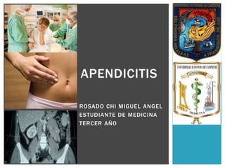 APENDICITIS
ROSADO CHI MIGUEL ANGEL
ESTUDIANTE DE MEDICINA
TERCER AÑO

 