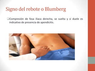 Signo del rebote o Blumberg
Compresión de fosa iliaca derecha, se suelta y si duele es
indicativo de presencia de apendicitis.

 