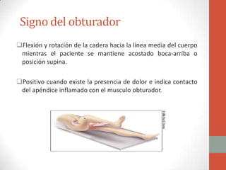 Signo del obturador
Flexión y rotación de la cadera hacia la línea media del cuerpo
mientras el paciente se mantiene acostado boca-arriba o
posición supina.
Positivo cuando existe la presencia de dolor e indica contacto
del apéndice inflamado con el musculo obturador.

 