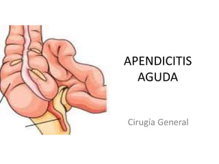APENDICITIS
AGUDA
Cirugía General
 