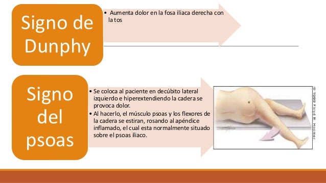 Signo Del Psoas Apendicitis | Guía de Práctica Clínica – AANR