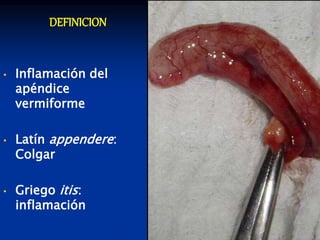DEFINICION
• Inflamación del
apéndice
vermiforme
• Latín appendere:
Colgar
• Griego itis:
inflamación
 