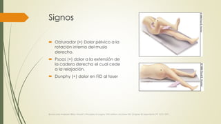 Signos
 Obturador (+) Dolor pélvico a la
rotación interna del muslo
derecho.
 Psoas (+) dolor a la extensión de
la cadera derecha el cual cede
a la relajación.
 Dunphy (+) dolor en FID al toser
Brunincardi Andersen Billiar, Shwart’s Principles of surgery 10th edition, McGraw Hill, Chapter 30 Apendicitis, PP 1073-1091.
 