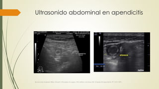 Ultrasonido abdominal en apendicitis
Brunincardi Andersen Billiar, Shwart’s Principles of surgery 10th edition, McGraw Hill, Chapter 30 Apendicitis, PP 1073-1091.
 