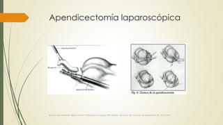 Apendicectomía laparoscópica
Brunincardi Andersen Billiar, Shwart’s Principles of surgery 10th edition, McGraw Hill, Chapter 30 Apendicitis, PP 1073-1091.
 