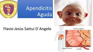 Apendicitis
Aguda
Flavio Jesùs Sattui D`Angelo
 