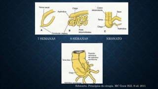 7 SEMANAS 8 SEMANAS NEONATO
Schwartz. Principios de cirugía. MC Graw Hill. 9 ed. 2011
 