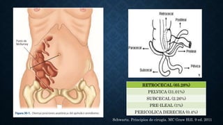 RETROCECAL (65.28%)
PELVICA (31.01%)
SUBCECAL (2.26%)
PRE-ILEAL (1%)
PERICOLICA DERECHA (0.4%)
Schwartz. Principios de cirugía. MC Graw Hill. 9 ed. 2011
 