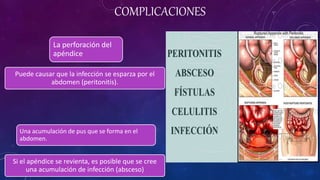 COMPLICACIONES
La perforación del
apéndice
Puede causar que la infección se esparza por el
abdomen (peritonitis).
Una acum...