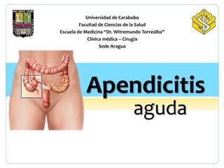 Universidad de Carabobo
Facultad de Ciencias de la Salud
Escuela de Medicina “Dr. Witremundo Torrealba”
Clínica médica – Cirugía
Sede Aragua
Apendicitis
aguda
 
