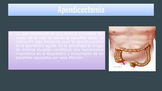Apendicectomía
● La apendicectomía es una técnica quirúrgica por
medio de la cual se extrae el apéndice cecal. La
indicación más frecuente para la apendicectomía
es la apendicitis aguda. En la actualidad la cirugía
de mínima invasión constituye una herramienta
importante en el diagnóstico y tratamiento de los
pacientes aquejados por esta afección.
 