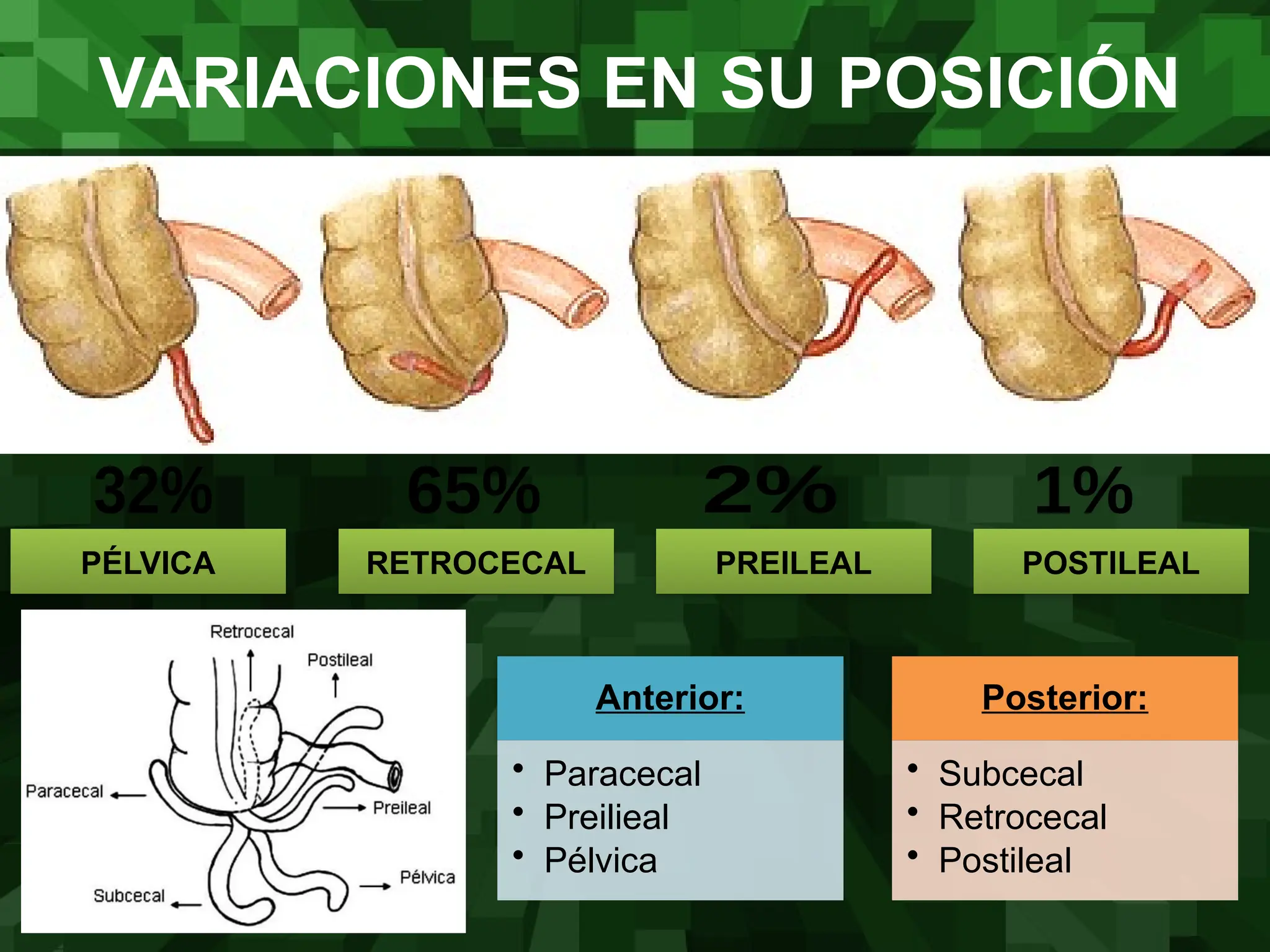 estudio de apendicitis y sus complicaciones.pptx