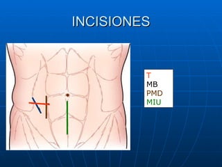 INCISIONES T MB PMD MIU 
