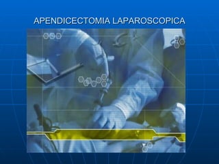 APENDICECTOMIA LAPAROSCOPICA 