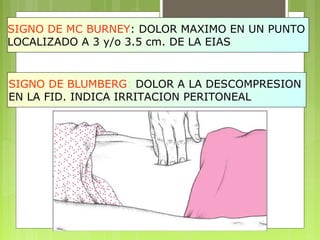 SIGNO DE MC BURNEY: DOLOR MAXIMO EN UN PUNTO 
LOCALIZADO A 3 y/o 3.5 cm. DE LA EIAS 
SIGNO DE BLUMBERG: DOLOR A LA DESCOMPRESION 
EN LA FID. INDICA IRRITACION PERITONEAL 
 