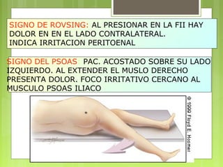 SIGNO DE ROVSING: AL PRESIONAR EN LA FII HAY 
DOLOR EN EN EL LADO CONTRALATERAL. 
INDICA IRRITACION PERITOENAL 
SIGNO DEL PSOAS: PAC. ACOSTADO SOBRE SU LADO 
IZQUIERDO. AL EXTENDER EL MUSLO DERECHO 
PRESENTA DOLOR. FOCO IRRITATIVO CERCANO AL 
MUSCULO PSOAS ILIACO 
 