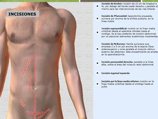 IINNCCIISSIIOONNEESS 
 