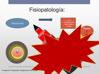 Fisiopatología:
Obstrucción
Presión
↑
0,1cc
Term.
Nerviosas
Fibras
Viscerales
(epigastrio)
• Moco
• Multiplicación
Bact delas q
rsiden
M
Congestiva/ Supurada/ Gangrenosa/ Perforada
 
