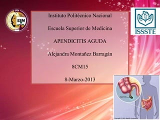 Instituto Politécnico Nacional
Escuela Superior de Medicina
APENDICITIS AGUDA
Alejandra Montañez Barragán
8CM15
8-Marzo-2013
 
