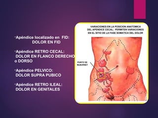 -Apéndice localizado en FID:
DOLOR EN FID
-Apéndice RETRO CECAL:
DOLOR EN FLANCO DERECHO
o DORSO
-Apéndice PELVICO:
DOLOR SUPRA PUBICO
-Apéndice RETRO ILEAL:
DOLOR EN GENITALES
 