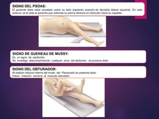 SIGNO DEL PSOAS:
El paciente debe estar acostado sobre su lado izquierdo: posición de decúbito lateral izquierdo. En esta
postura, se le pide al paciente que extienda su pierna derecha en dirección hacia su espalda.
SIGNO DE GUENEAU DE MUSSY:
Es un signo de peritonitis.
Se investiga descomprimiendo cualquier zona del abdomen: se produce dolor
SIGNO DEL OBTURADOR:
Al realizar rotacion interna del muslo der. Flexionado se presenta dolor.
Indica: irritacion cercana al musculo obturador
 