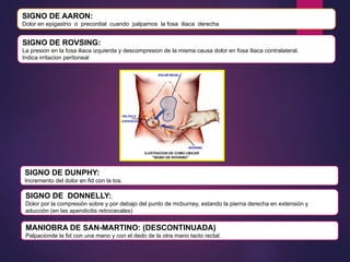 SIGNO DE AARON:
Dolor en epigastrio o precordial cuando palpamos la fosa iliaca derecha
SIGNO DE ROVSING:
La presion en la fosa iliaca izquierda y descompresion de la misma causa dolor en fosa iliaca contralateral.
Indica irritacion peritoneal
SIGNO DE DUNPHY:
Incremento del dolor en fid con la tos.
SIGNO DE DONNELLY:
Dolor por la compresión sobre y por debajo del punto de mcburney, estando la pierna derecha en extensión y
aducción (en las apendicitis retrocecales)
MANIOBRA DE SAN-MARTINO: (DESCONTINUADA)
Palpacionde la fid con una mano y con el dedo de la otra mano tacto rectal.
 