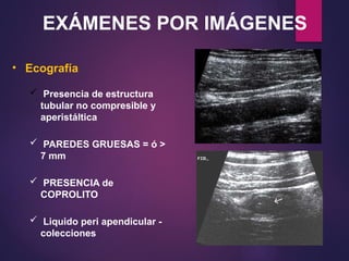 EXÁMENES POR IMÁGENES
• Ecografía
 Presencia de estructura
tubular no compresible y
aperistáltica
 PAREDES GRUESAS = ó >
7 mm
 PRESENCIA de
COPROLITO
 Liquido peri apendicular -
colecciones
 