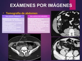 EXÁMENES POR IMÁGENES
• Tomografía de abdomen
HALLAZGOS PRIMARIOS
•AUMENTO del DIAMETRO
TRANSVERSO del APENDICE > 6
mm
•ENGROSAMIENTO de la PARED
del APENDICE > 1mm
•REALCE ANORMAL y
HETEROGENEO de la PARED
•EDEMA SUBMUCOSO
•COPROLITO (APENDICOLITO)
HALLAZGOS SECUNDARIOS
•ENGROSAMIENTO de las
PAREDES del CIEGO
•ALTERACION en la DENSIDAD de
la GRASA APENDICULAR
•ADENOMEGALIAS REGIONALES
•SIGNOS DE PERFORACION: Gas
Extraluminal – Absceso –
Flegmon – Coprolito
(apendicolito) Extraluminal
 