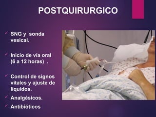  SNG y sonda
vesical.
 Inicio de vía oral
(6 a 12 horas) .
 Control de signos
vitales y ajuste de
líquidos.
 Analgésicos.
 Antibióticos
POSTQUIRURGICO
 