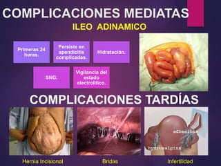 COMPLICACIONES MEDIATAS
ILEO ADINAMICO
Primeras 24
horas.
Persiste en
apendicitis
complicadas.
Hidratación.
SNG.
Vigilancia del
estado
electrolitico.
COMPLICACIONES TARDÍAS
Hernia Incisional Bridas Infertilidad
 
