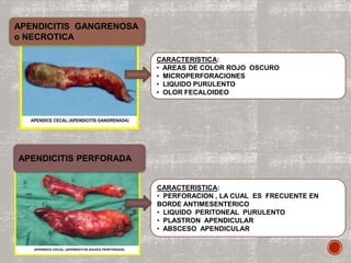 APENDICITIS GANGRENOSA
o NECROTICA
CARACTERISTICA:
• AREAS DE COLOR ROJO OSCURO
• MICROPERFORACIONES
• LIQUIDO PURULENTO
• OLOR FECALOIDEO
APENDICITIS PERFORADA
CARACTERISTICA:
• PERFORACION , LA CUAL ES FRECUENTE EN
BORDE ANTIMESENTERICO
• LIQUIDO PERITONEAL PURULENTO
• PLASTRON APENDICULAR
• ABSCESO APENDICULAR
 