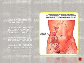 -Apéndice localizado en FID:
DOLOR EN FID
-Apéndice RETRO CECAL:
DOLOR EN FLANCO
DERECHO o DORSO
-Apéndice PELVICO:
DOLOR SUPRA PUBICO
-Apéndice RETRO ILEAL:
DOLOR EN GENITALES
 
