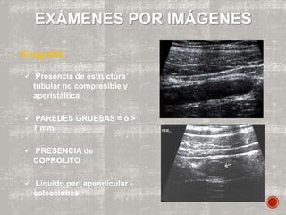 EXÁMENES POR IMÁGENES
• Ecografía
 Presencia de estructura
tubular no compresible y
aperistáltica
 PAREDES GRUESAS = ó >
7 mm
 PRESENCIA de
COPROLITO
 Liquido peri apendicular -
colecciones
 