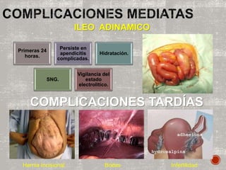 ILEO ADINAMICO
Primeras 24
horas.
Persiste en
apendicitis
complicadas.
Hidratación.
SNG.
Vigilancia del
estado
electrolitico.
COMPLICACIONES TARDÍAS
Hernia Incisional Bridas Infertilidad
 