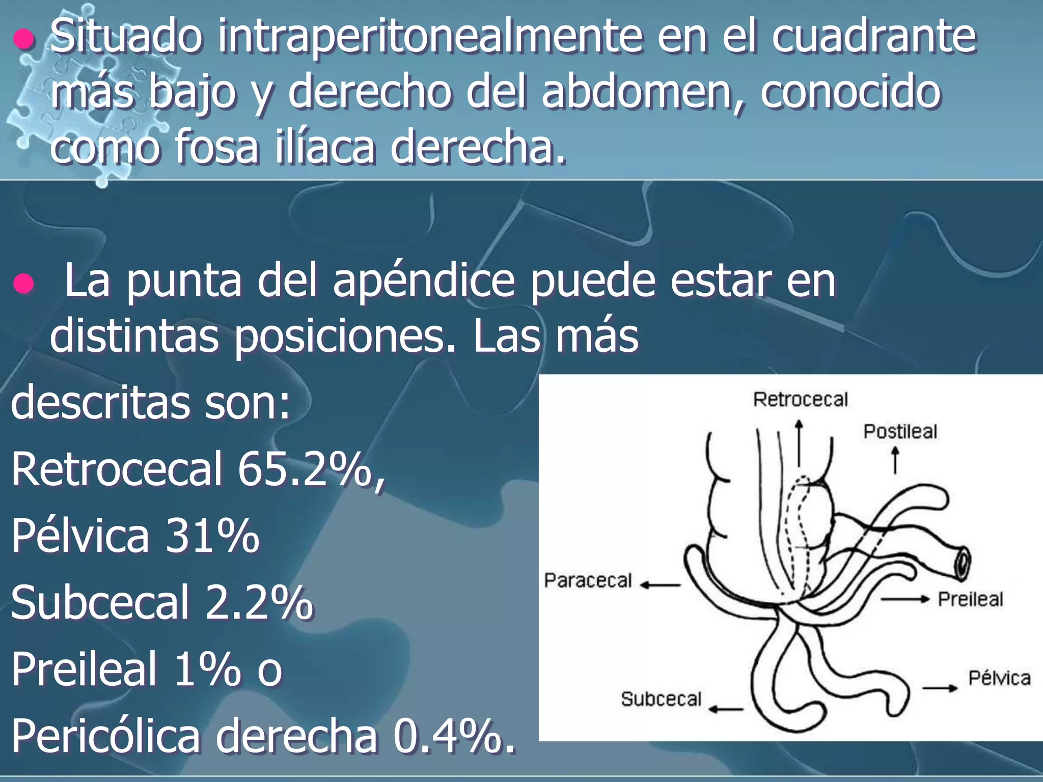 Apendicitis PPTX