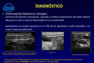 • Ecotomografia Abdominal, hallazgos:
- Aumento del diámetro apendicular, asociado a cambios inflamatorios del tejido adiposo
adyacente, el que se aprecia hiperecogénico y no compresible
- Apendicolitos se pueden observar en un 30% de las apendicitis y están asociados a un
mayor riesgo de perforación
DIAGNÓSTICO
Acute appendicitis: Meta-analysis of diagnosis performance of CT an graded compression US related to
prevalence of disease. Radiology: Volume 249: Number 1- October 2008
Apendicitis aguda. Paredes engrosadas (flecha blanca), asociada a
cambios inflamatorios periapendiculares (puntas de flecha).
Apendicolito
Aumento del lumen apendicular
 