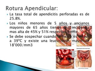 La tasa total de apendicitis perforadas es de 25.8%.Los niños menores de 5 años y ancianos mayores de 65 años tienen una incidencia mas alta de 45% y 51% respectivamente.Se debe sospechar cuando la fiebre es mayor a 39ºC y existe una leucocitosis mayor de 18’000/mm3Rotura Apendicular: