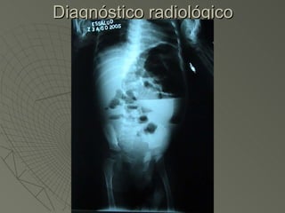 Diagnóstico radiológico 