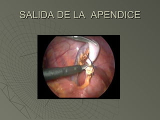 SALIDA DE LA  APENDICE 