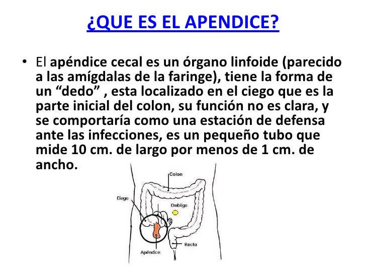 Apendicitis aguda