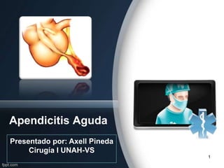 Apendicitis Aguda
Presentado por: Axell Pineda
     Cirugía I UNAH-VS
                               1
 