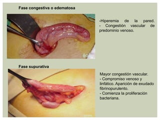 Fase congestiva o edematosa
-Hiperemia de la pared.
- Congestión vascular de
predominio venoso.

Fase supurativa
Mayor congestión vascular.
- Compromiso venoso y
linfático. Aparición de exudado
fibrinopurulento.
- Comienza la proliferación
bacteriana.

 
