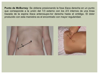 Punto de McBurney: Se obtiene presionando la fosa ilíaca derecha en un punto
que corresponde a la unión del 1/3 externo con los 2/3 internos de una línea
trazada de la espina ilíaca anterosupe-rior derecha hasta el ombligo. El dolor
producido con esta maniobra es el encontrado con mayor regularidad.

 