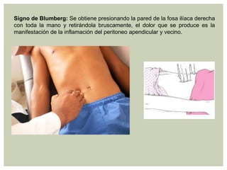 Signo de Blumberg: Se obtiene presionando la pared de la fosa ilíaca derecha
con toda la mano y retirándola bruscamente, el dolor que se produce es la
manifestación de la inflamación del peritoneo apendicular y vecino.

 