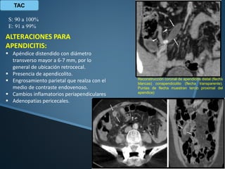 TAC
S: 90 a 100%
E: 91 a 99%
ALTERACIONES PARA
APENDICITIS:
 Apéndice distendido con diámetro
transverso mayor a 6-7 mm, por lo
general de ubicación retrocecal.
 Presencia de apendicolito.
 Engrosamiento parietal que realza con el
medio de contraste endovenoso.
 Cambios inflamatorios periapendiculares
 Adenopatías pericecales.
Reconstrucción coronal de apendicitis distal (flechs
blancas) conapendicolito (flecha transparente).
Puntas de flecha muestran tercio proximal del
apendice)
 